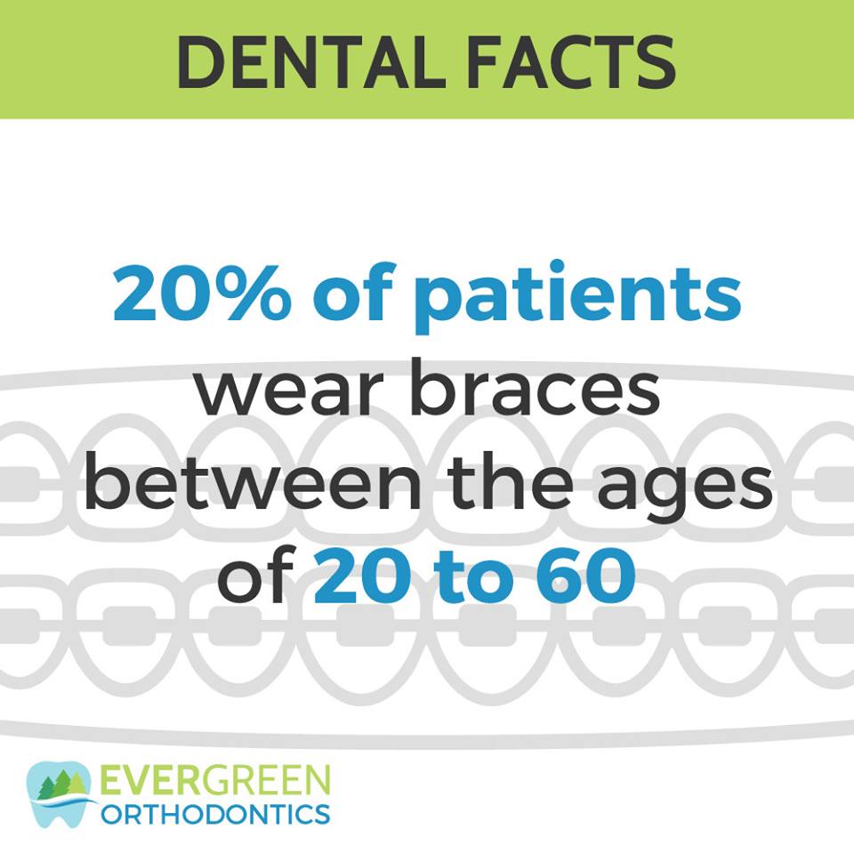 #‎Braces‬ aren't just for kids and teenagers anymore. More and more adults are taking the plunge!