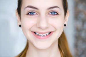 Teen with braces evergreen orthodontics coquitlam